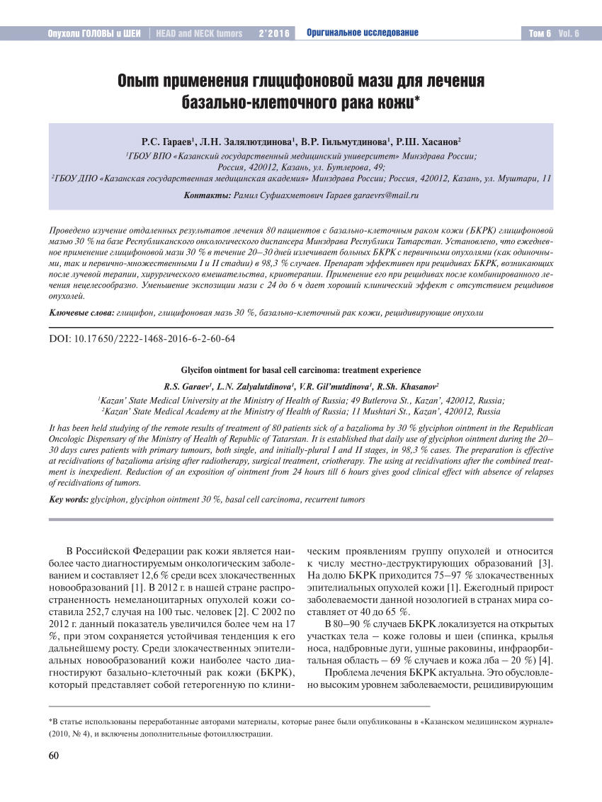 PDF) Glycifon ointment for basal cell carcinoma: treatment experience