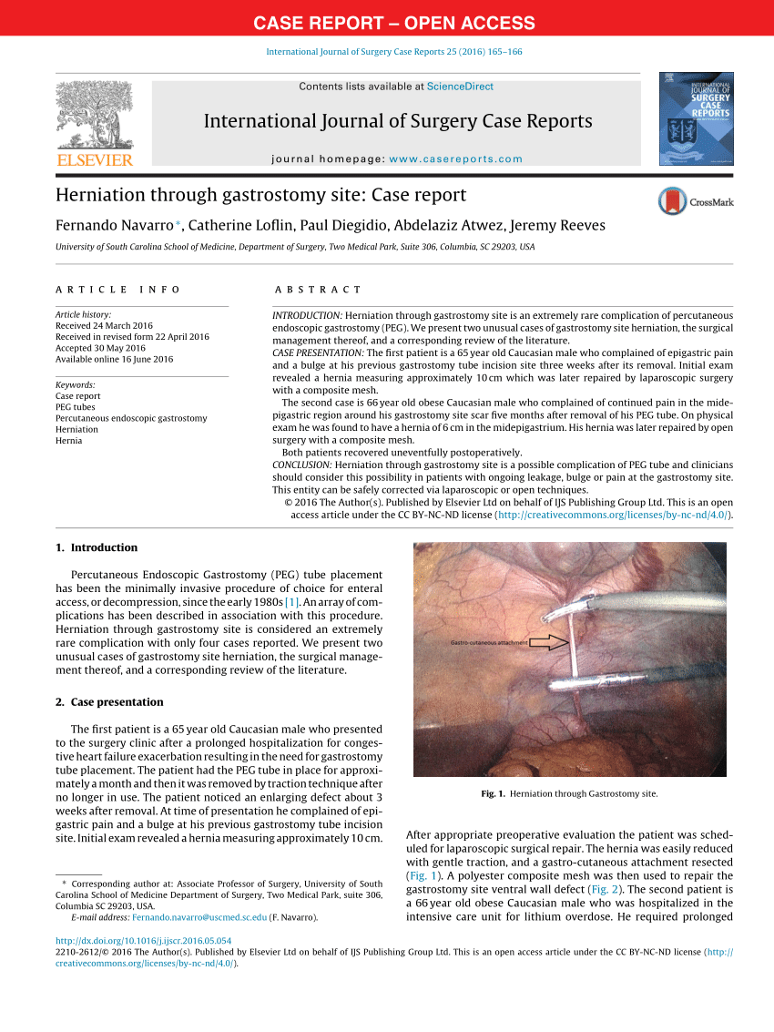 (PDF) Herniation through Gastrostomy Site: Case Report