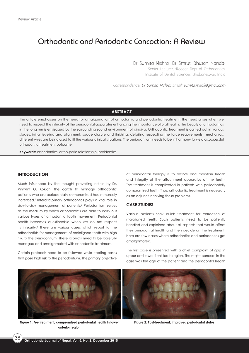 Orthodontic treatment and periodontally compromised patients: effects of  the treatment