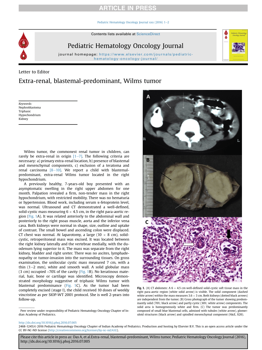 Pdf Extra Renal Blastemal Predominant Wilms Tumor