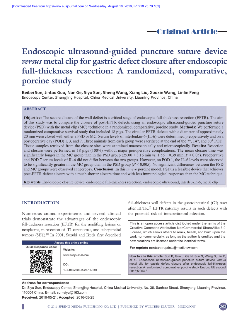 Endoscopic Full Thickness Resection Using Suture Loop Needle T Tag Tissue Anchors In The Porcine Stomach With Video Gastrointestinal Endoscopy