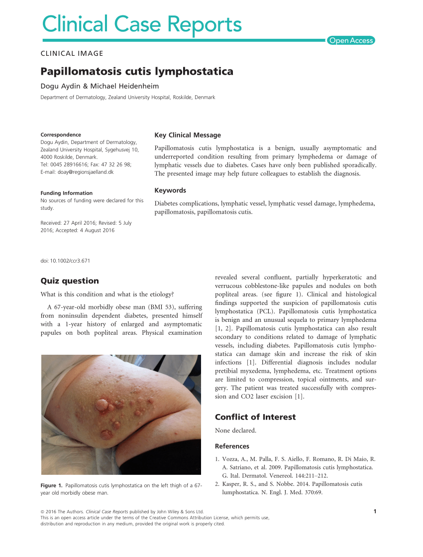 lymphatic papillomatosis treatment