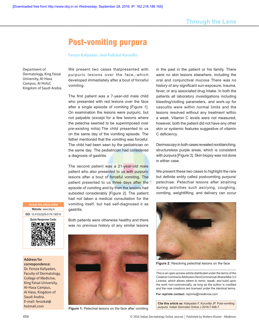 pdf-post-vomiting-purpura