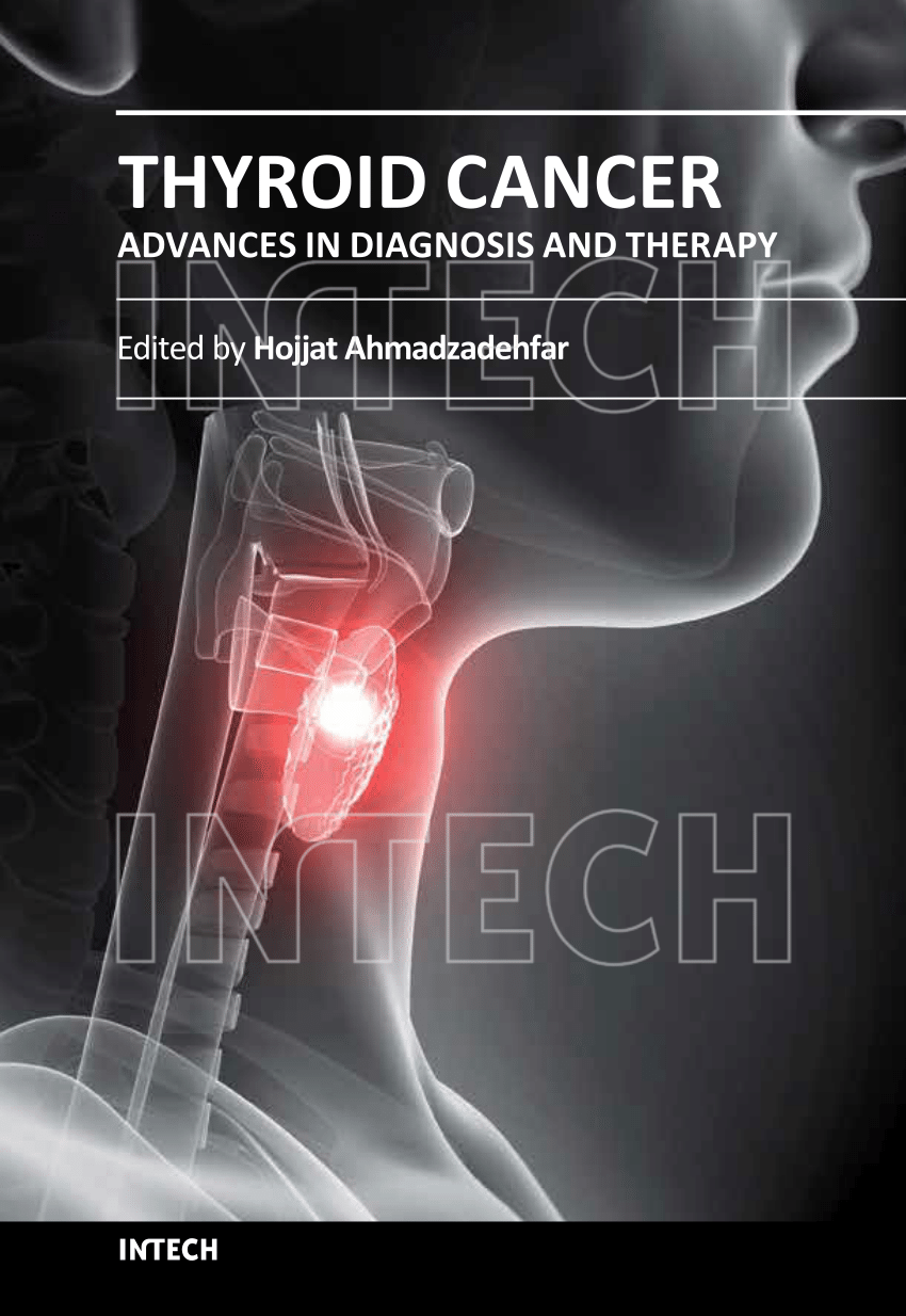PDF) Thyroid Cancer