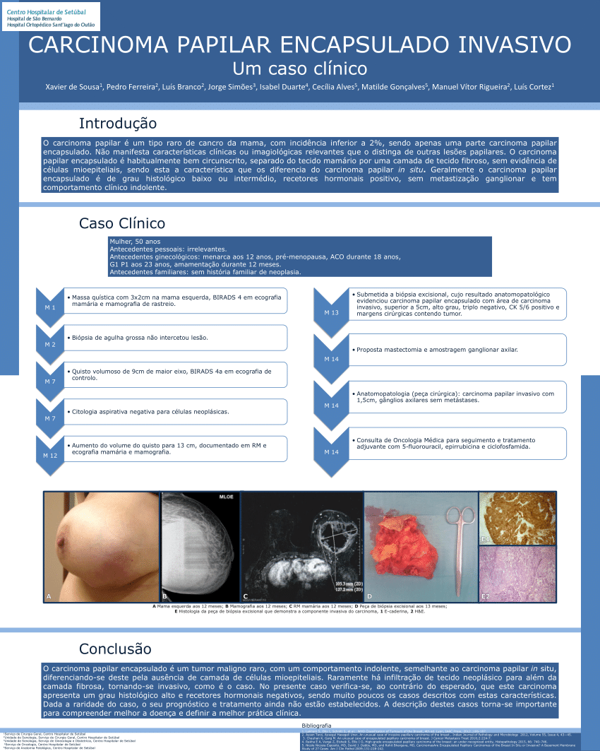 Câncer de mama multifocal/multicêntrico: Perfil clínico