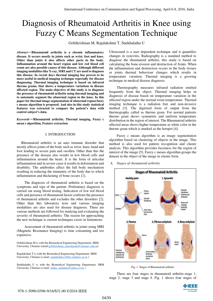 research paper on rheumatoid arthritis