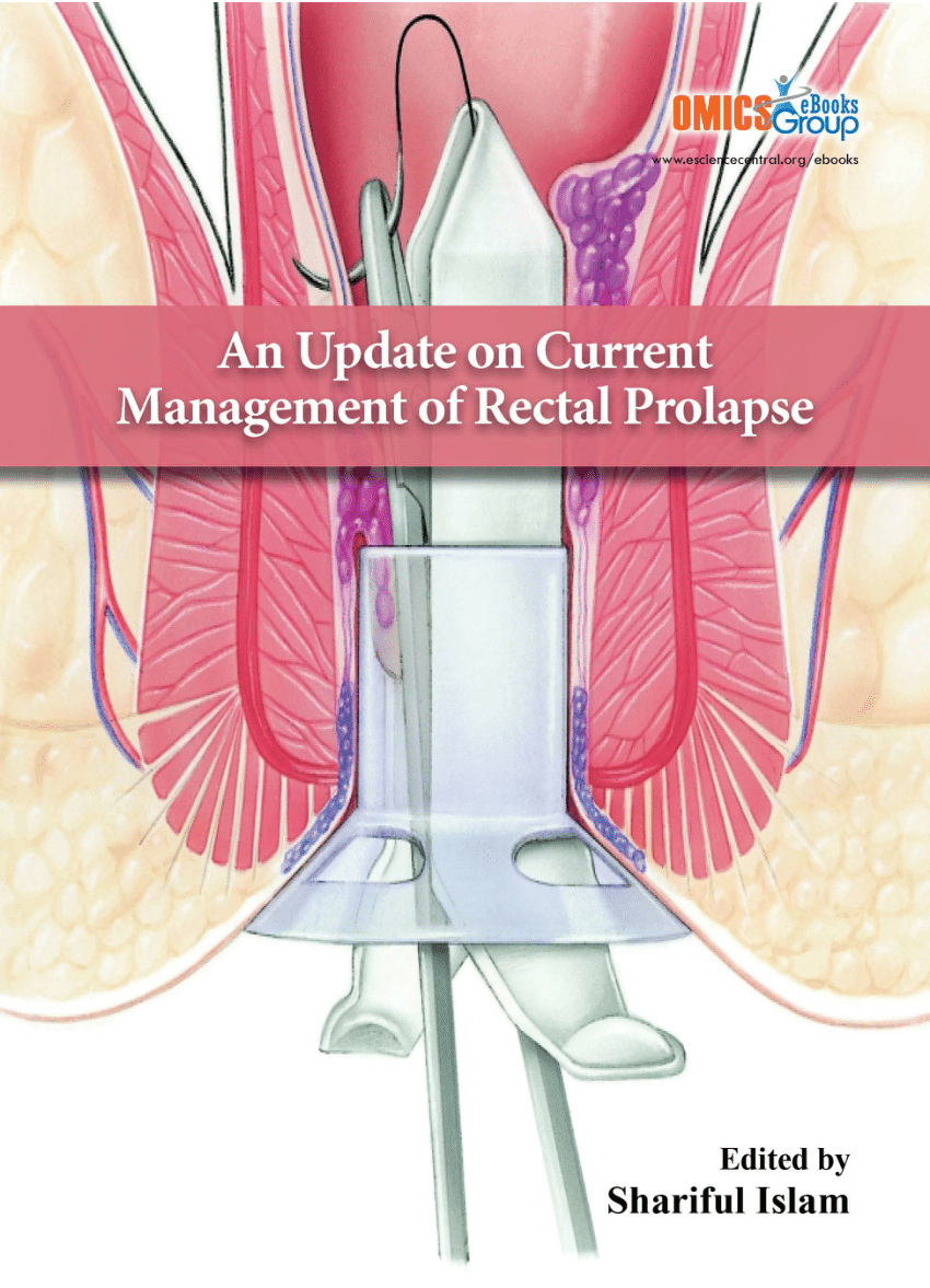 (PDF) An Update on Current Management of Rectal Prolapse