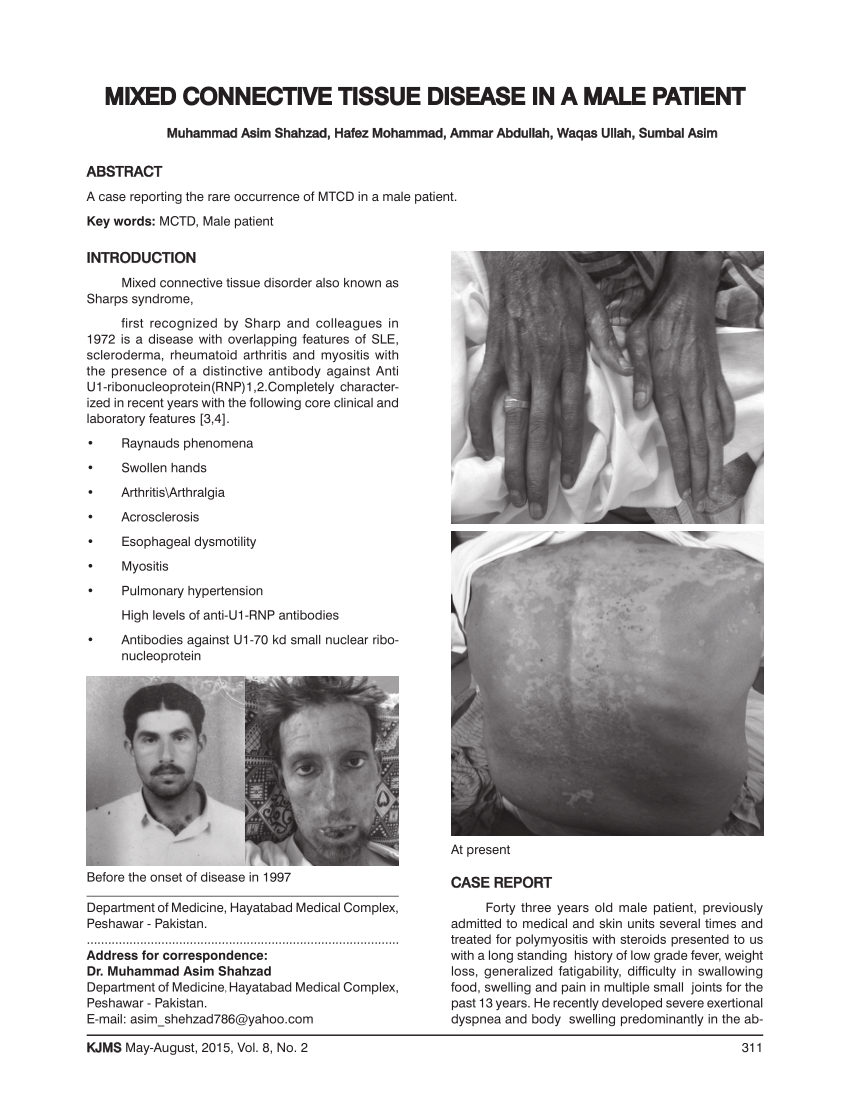 (PDF) MIXED CONNECTIVE TISSUE DISEASE IN A MALE PATIENT