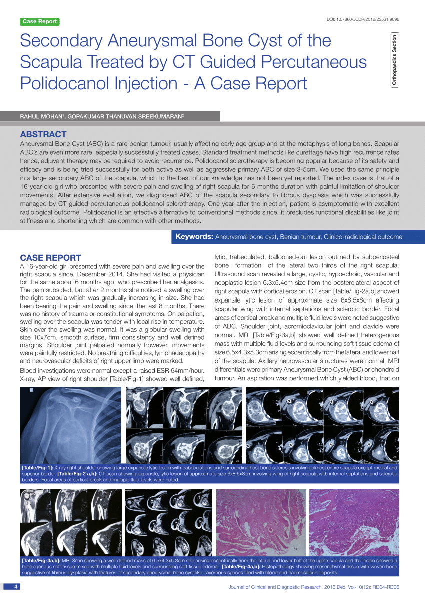 Pdf Secondary Aneurysmal Bone Cyst Of The Scapula Treated By Ct Guided Percutaneous 9789