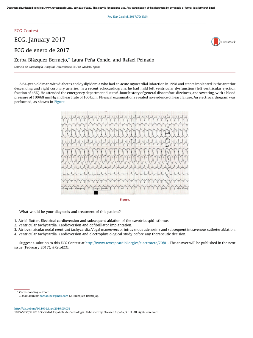 PDF ECG January 2017