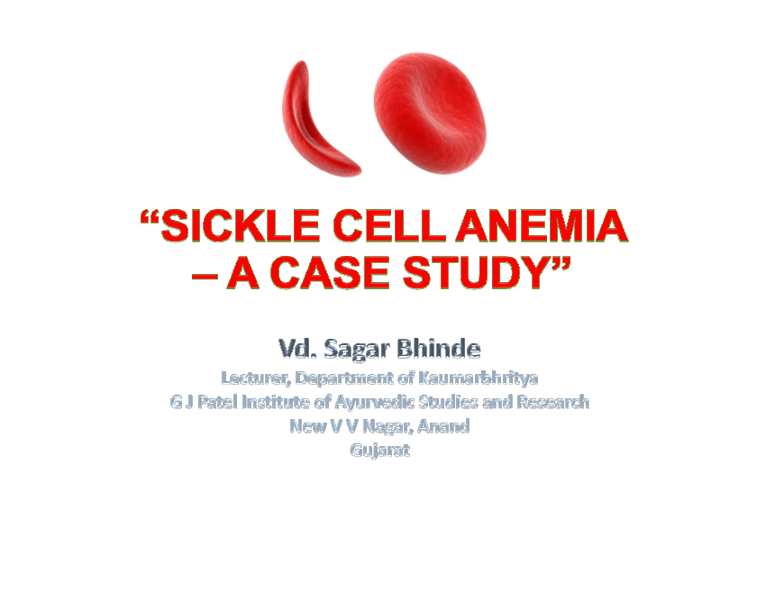 primary research article on sickle cell anemia