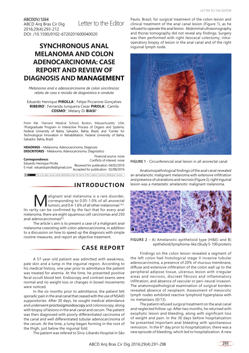 Pdf Synchronous Anal Melanoma And Colon Adenocarcinoma Case Report And Review Of Diagnosis 