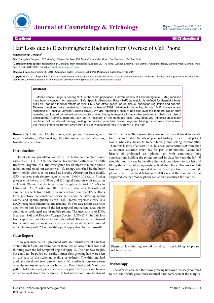 PDF) Hair Loss due to Electromagnetic Radiation from Overuse of Cell Phone