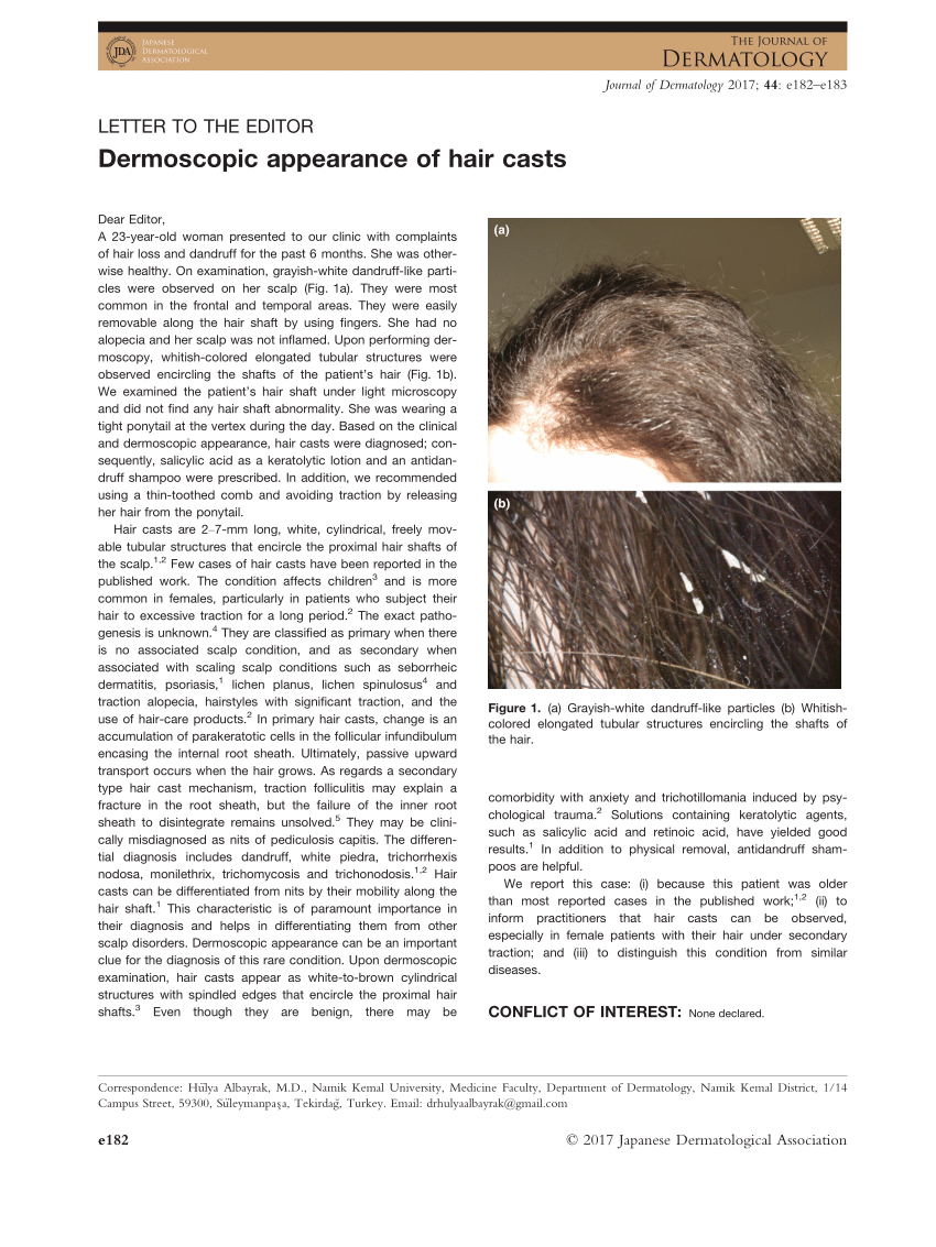 PDF) Dermoscopic appearance of hair casts