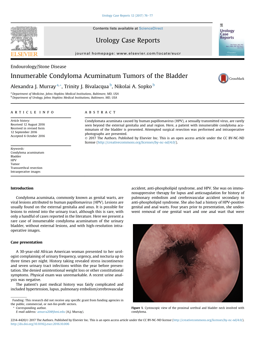 condylomata acuminata and human genital cancer unguent de papilom claridol