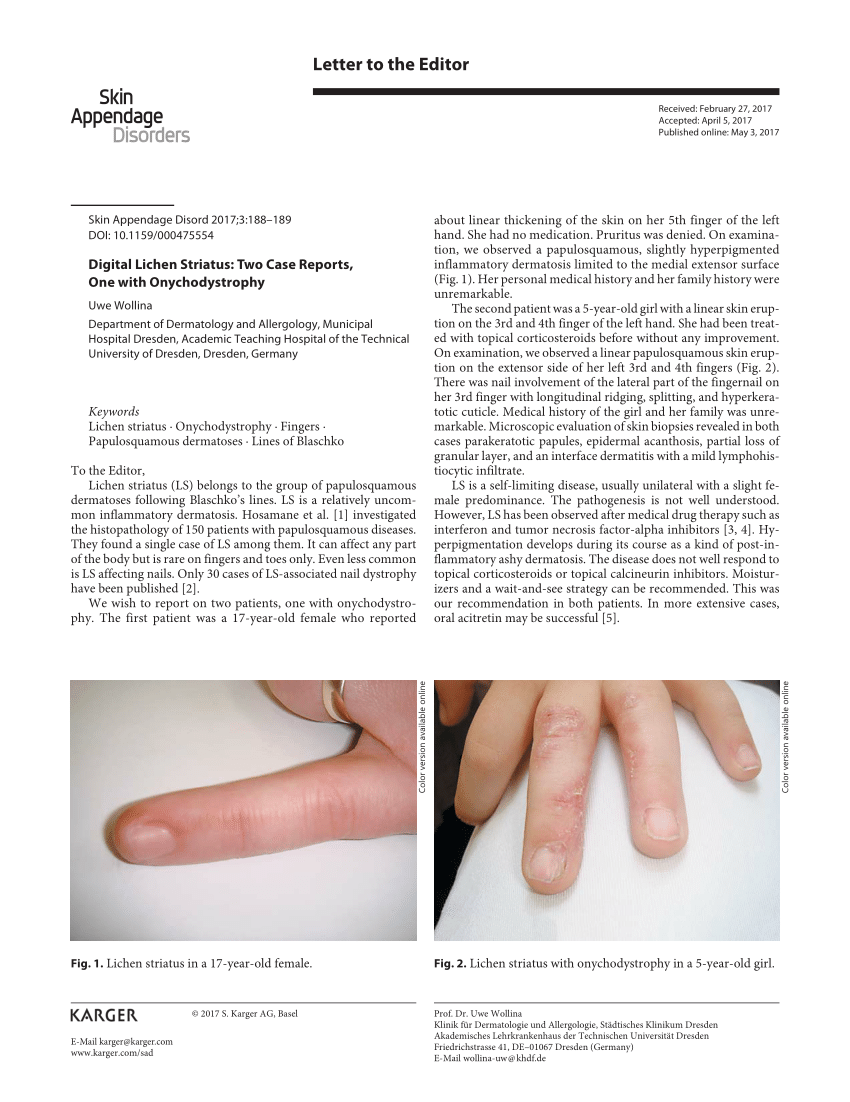 PDF) Lichen Striatus with Nail Involvement in a 6-Year-Old Boy | Alexander  Leung - Academia.edu