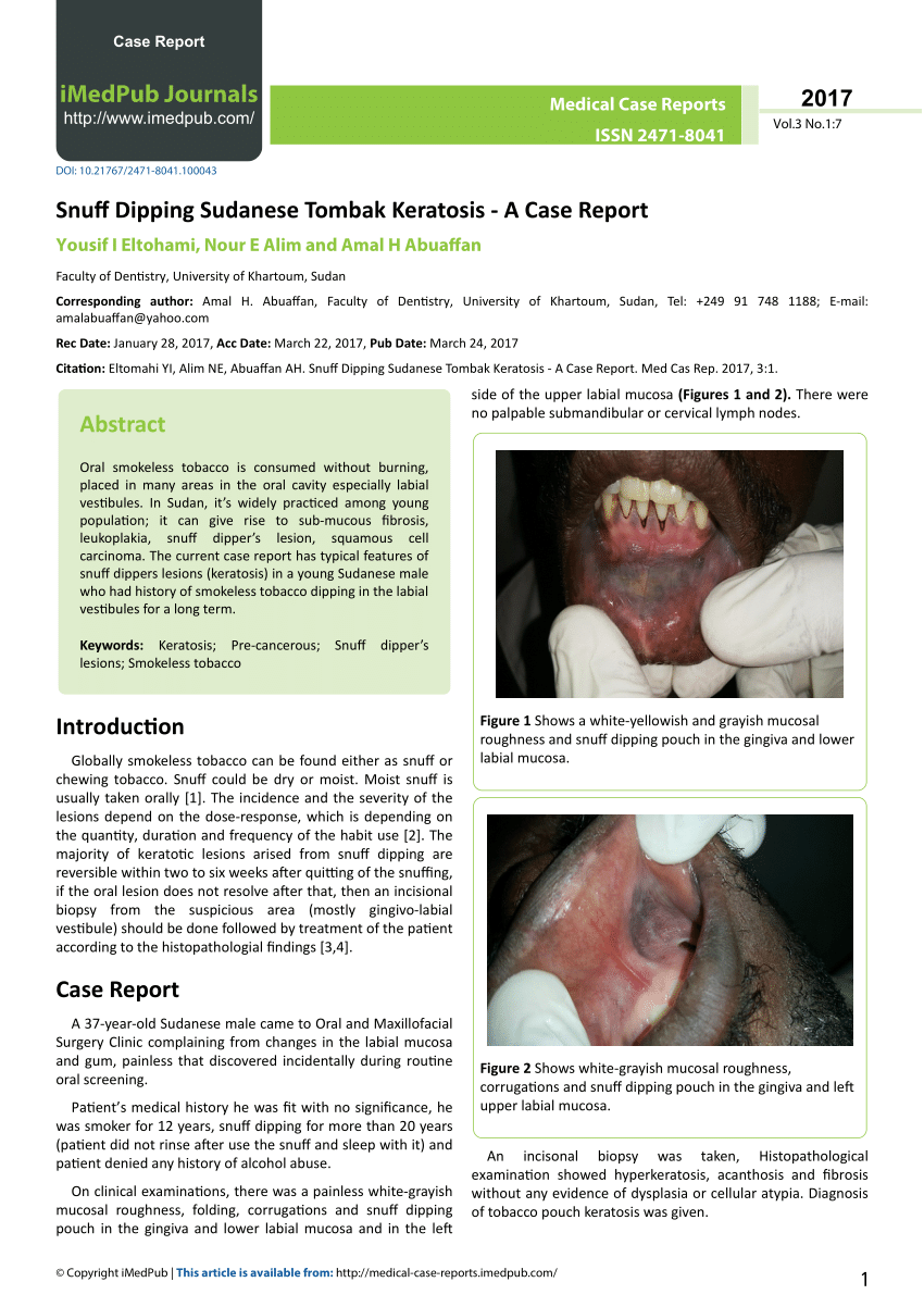 Pdf Snuff Dipping Sudanese Tombak Keratosis A Case Report