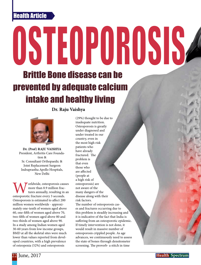 thesis on osteoporosis pdf