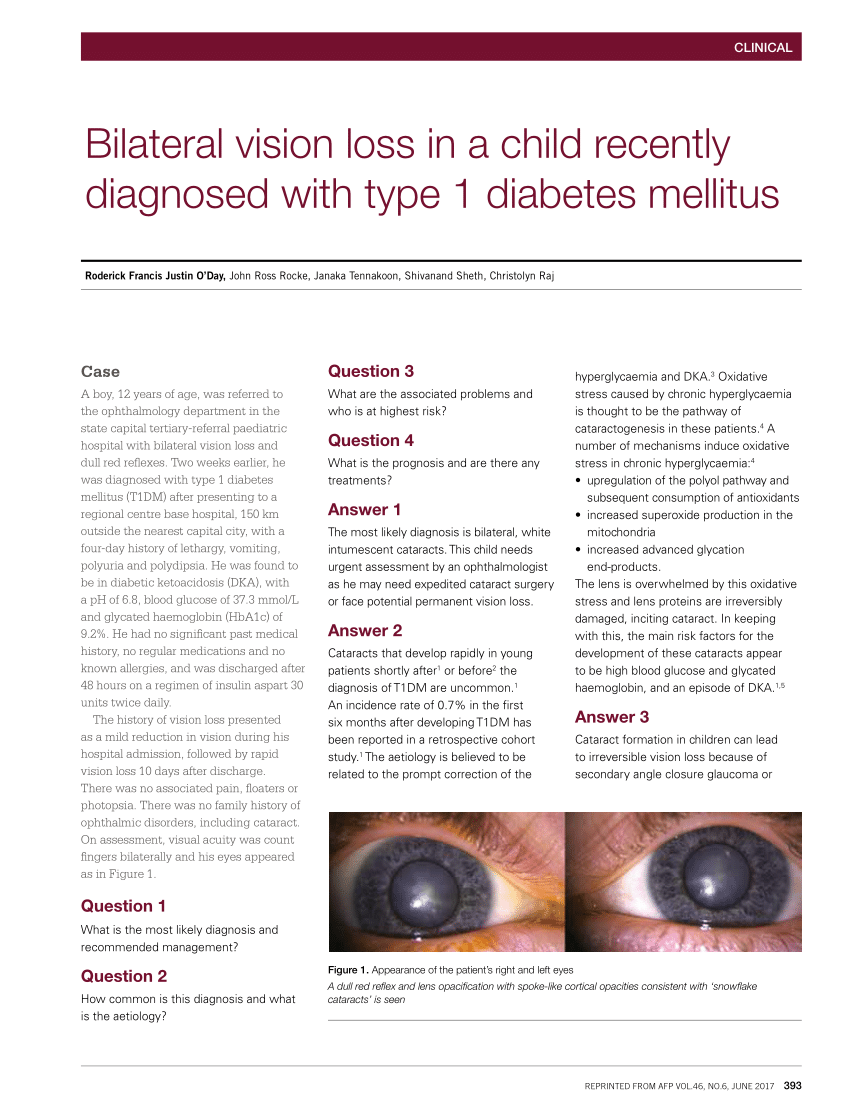 cataract diabetes mellitus