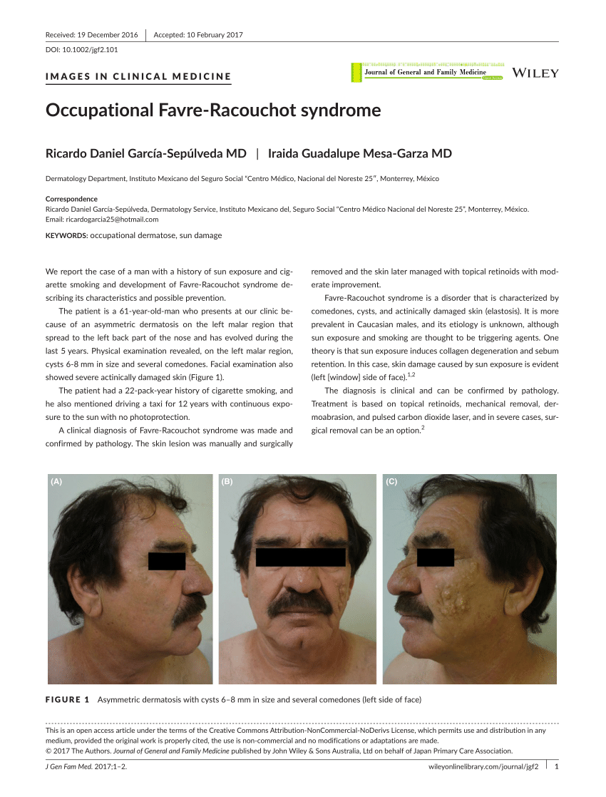 (PDF) Occupational Favre‐Racouchot syndrome