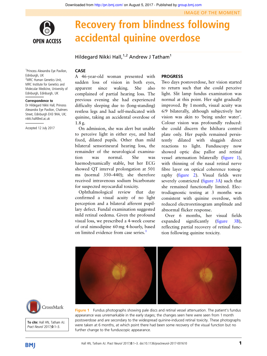 Pdf Recovery From Blindness Following Accidental Quinine Overdose