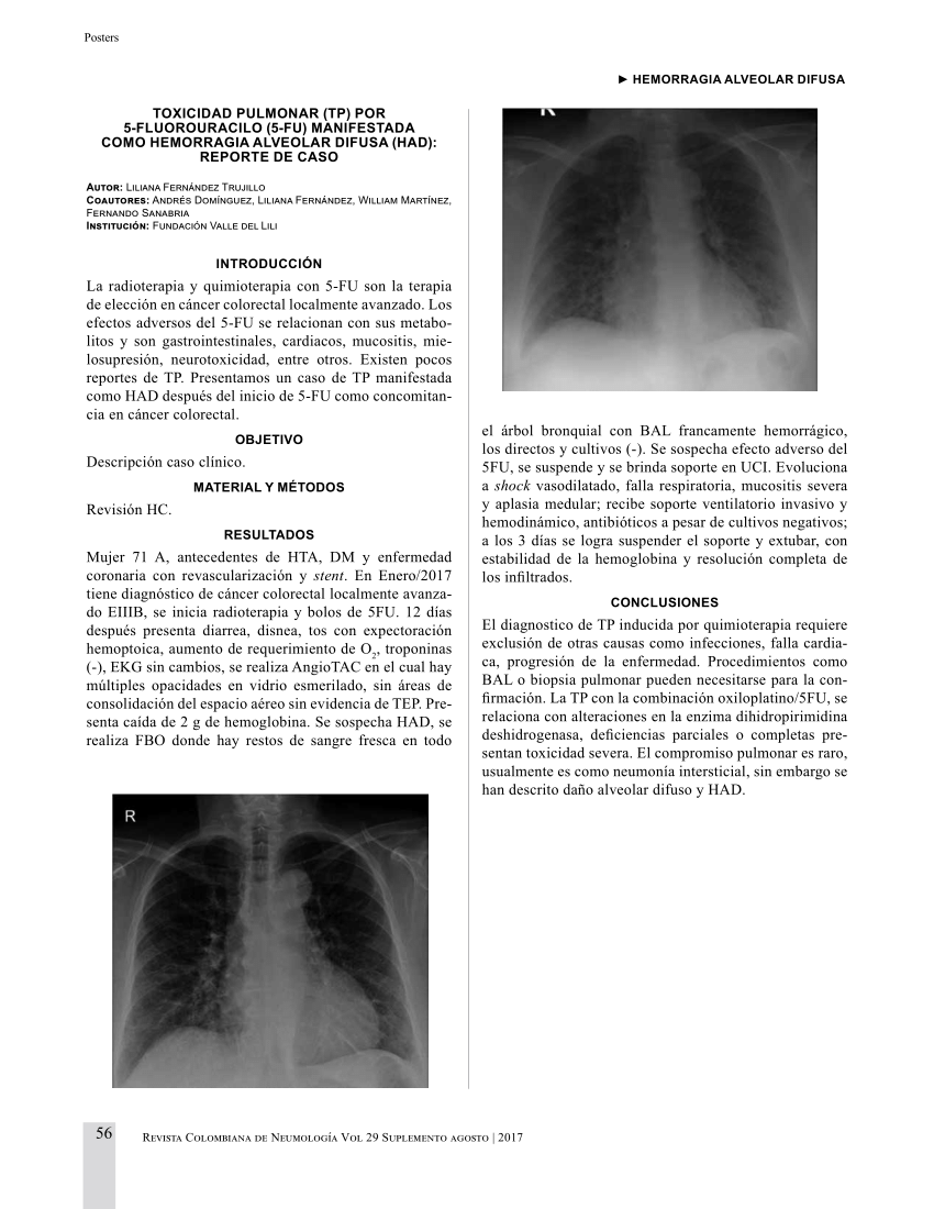 Pdf Toxicidad Pulmonar Tp Por 5 Fluorouracilo 5 Fu Manifestada Como Hemorragia Alveolar