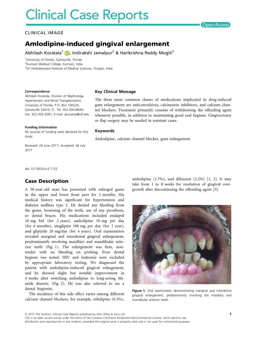 pdf-amlodipine-induced-gingival-enlargement