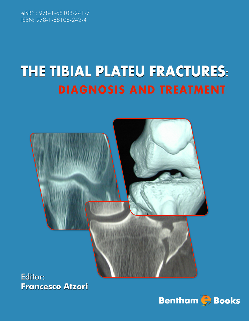 tibial plateau compression fracture treatment