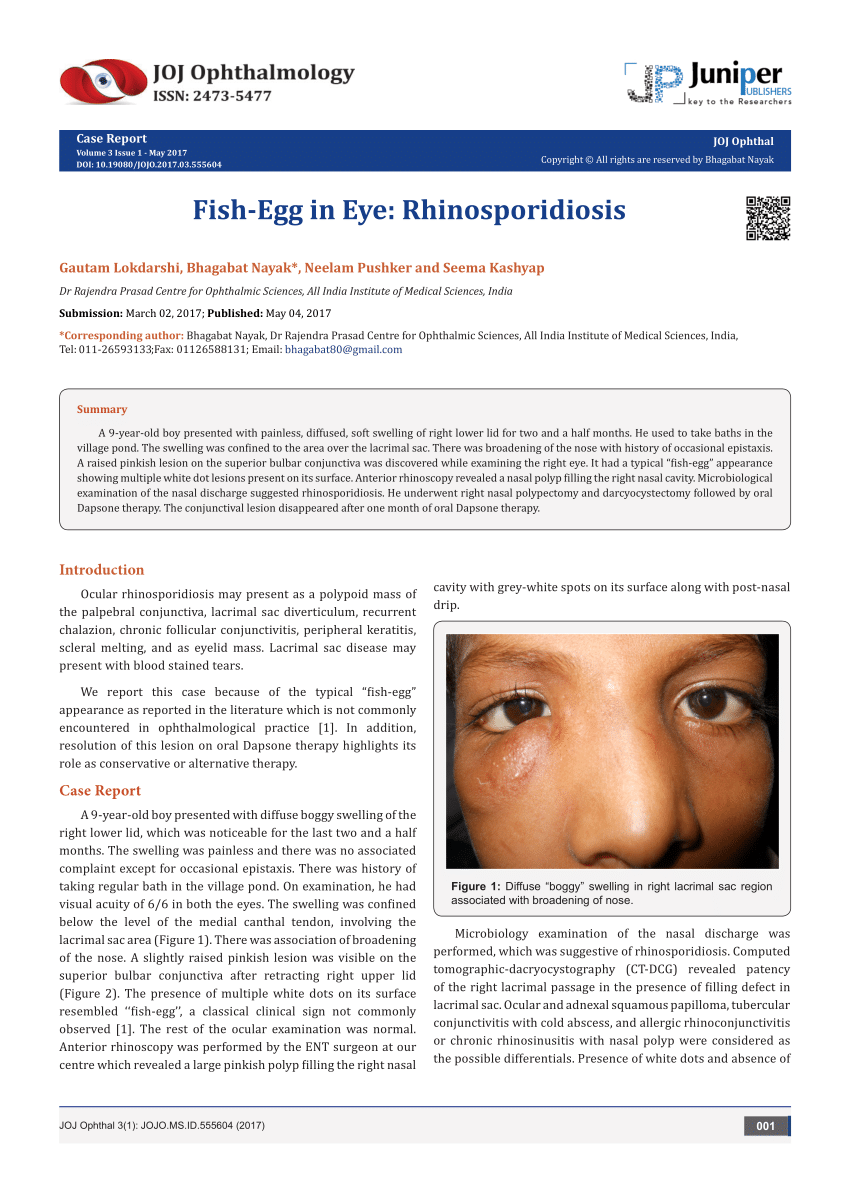 PDF) Fish-Egg in Eye: Rhinosporidiosis