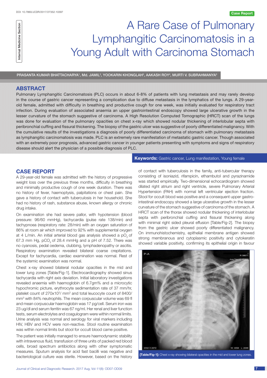 Pdf A Rare Case Of Pulmonary Lymphangitic Carcinomatosis In A Young Adult With Carcinoma Stomach 