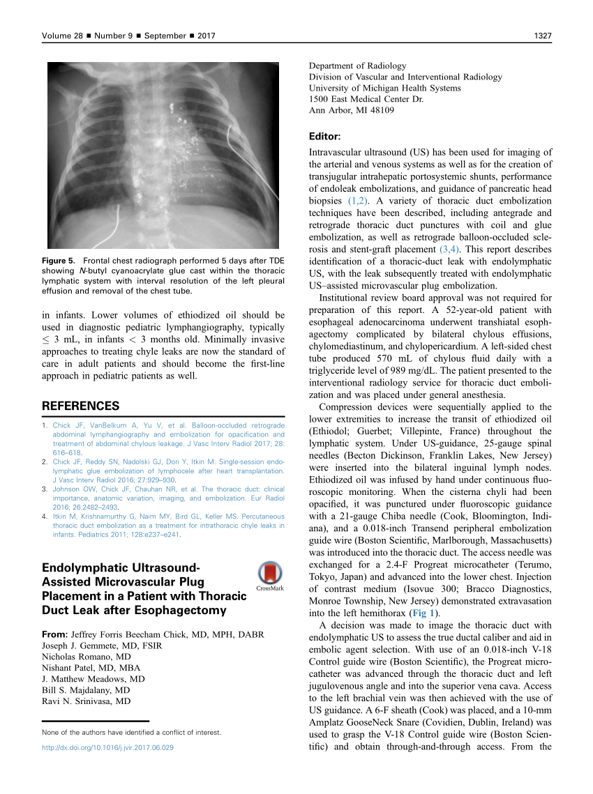 Pdf Endolymphatic Ultrasound Assisted Microvascular Plug Placement In