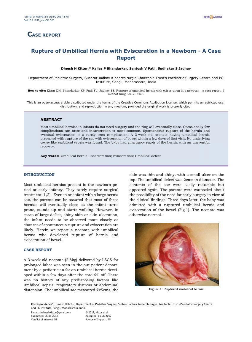PDF] Spontaneous rupture of a congenital umbilical hernia in an