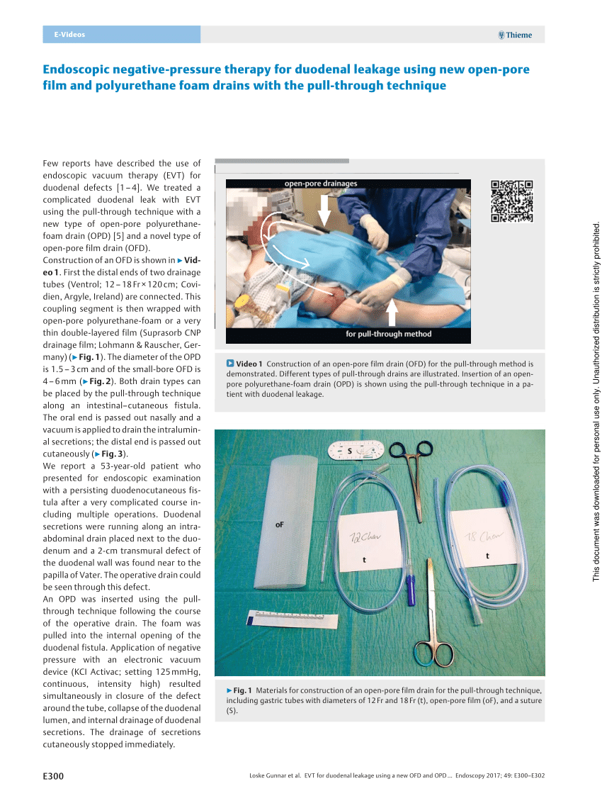 Pdf Endoscopic Negative Pressure Therapy For Duodenal Leakage Using New Open Pore Film And