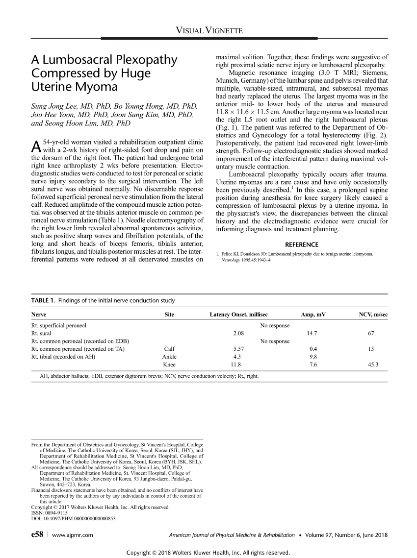 Pdf A Lumbosacral Plexopathy Compressed By Huge Uterine Myoma 