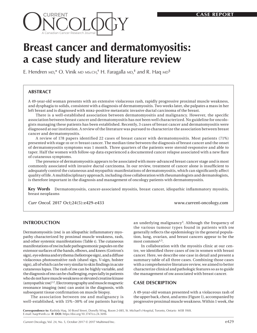 breast cancer and dermatomyositis a case study and literature review