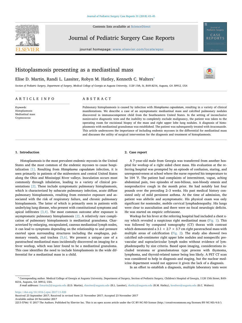 Anterior mediastinal masses in children - ScienceDirect