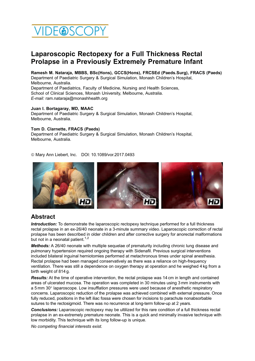 Pdf Laparoscopic Rectopexy For A Full Thickness Rectal Prolapse In A Previously Extremely