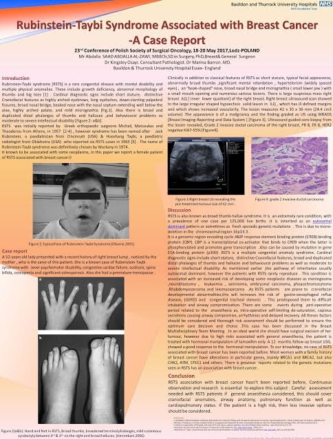 Rubinstein-Taybi syndrome associated with breast cancer — a case