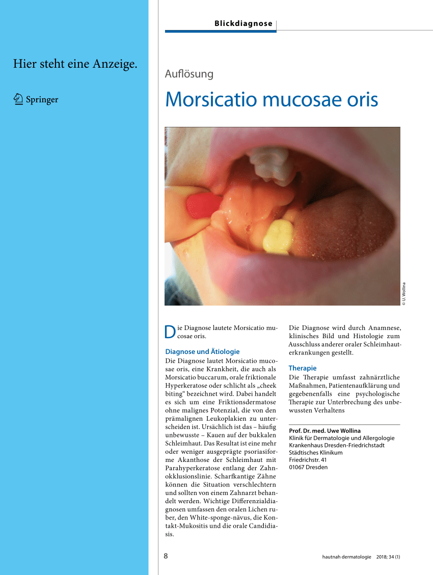 (PDF) Morsicatio mucosae oris