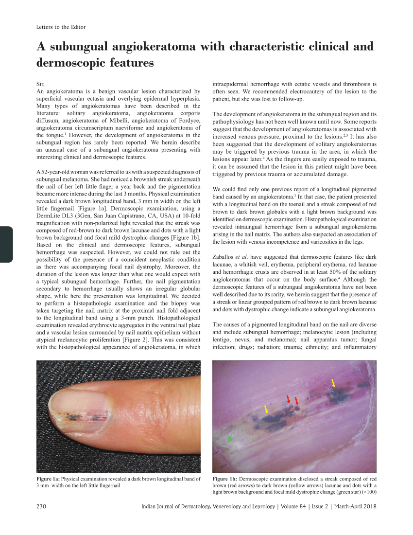 Erythematous Friable Papule Under the Great Toenail | MDedge Dermatology