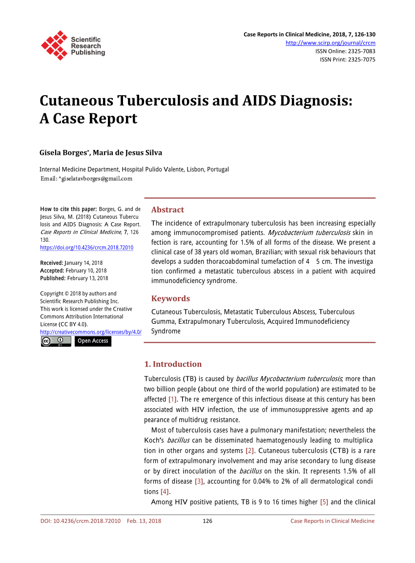 hiv and tuberculosis case study