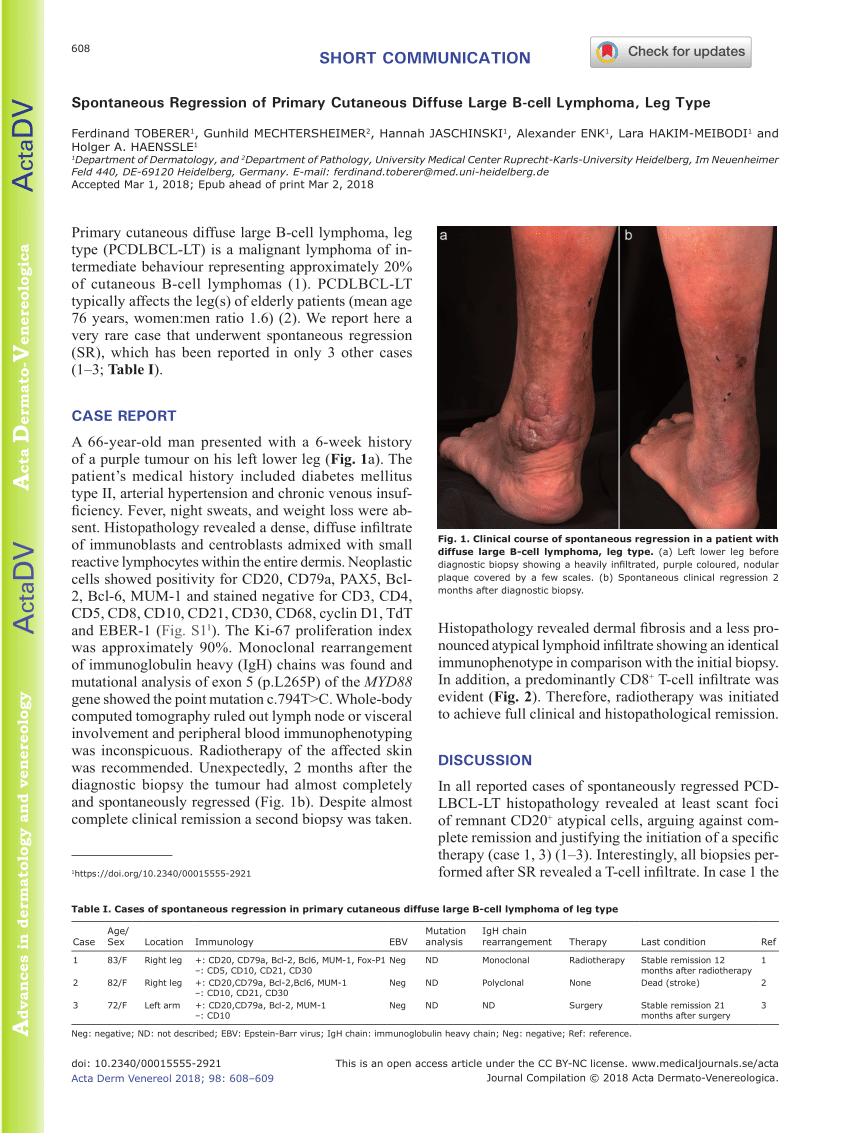 Pdf Spontaneous Regression Of Primary Cutaneous Diffuse Large B Cell Lymphoma Leg Type 