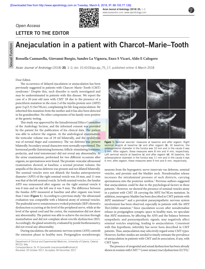 PDF Anejaculation in a patient with Charcot Marie Tooth