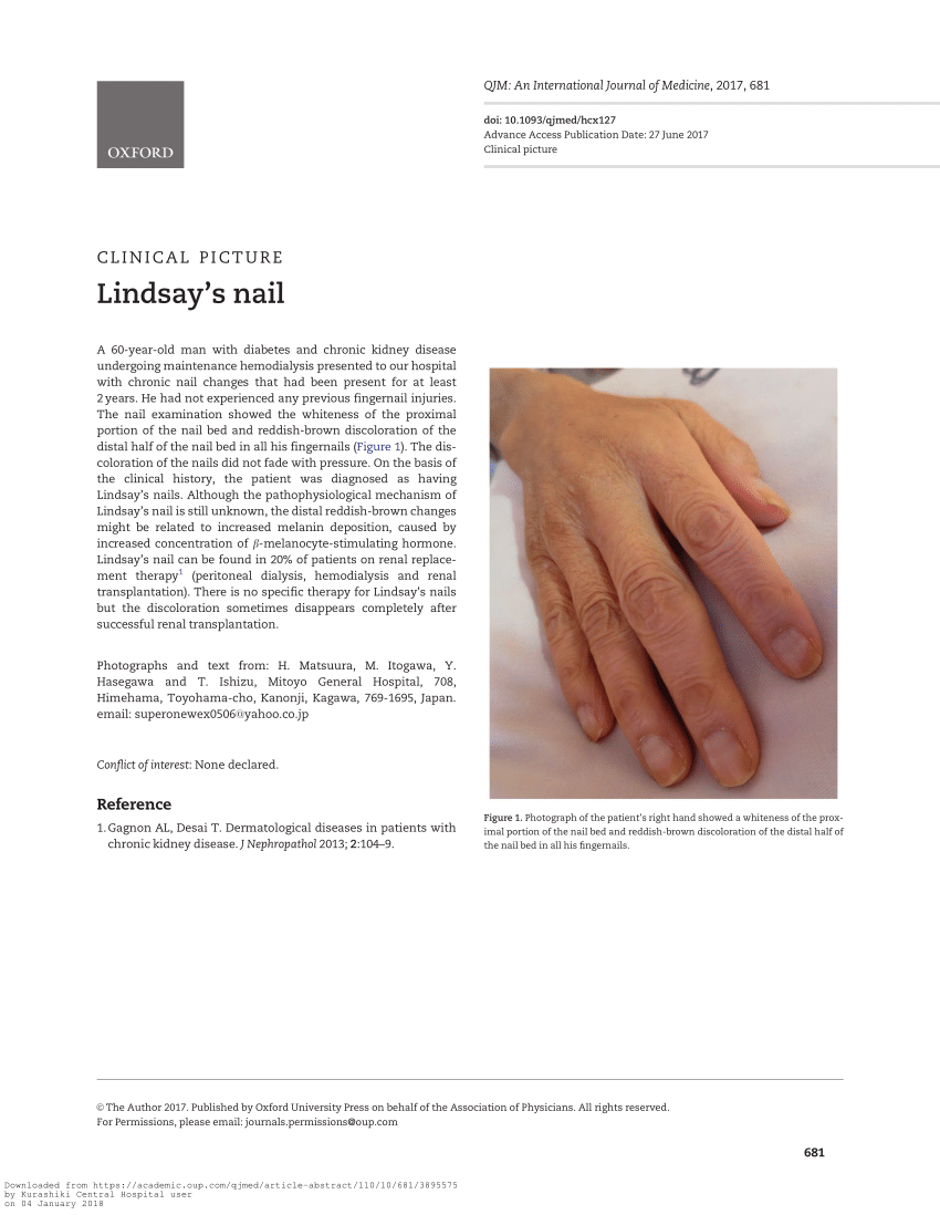Lindsay's nails | Aprendi num tutorial com as meninas do Mão… | Flickr