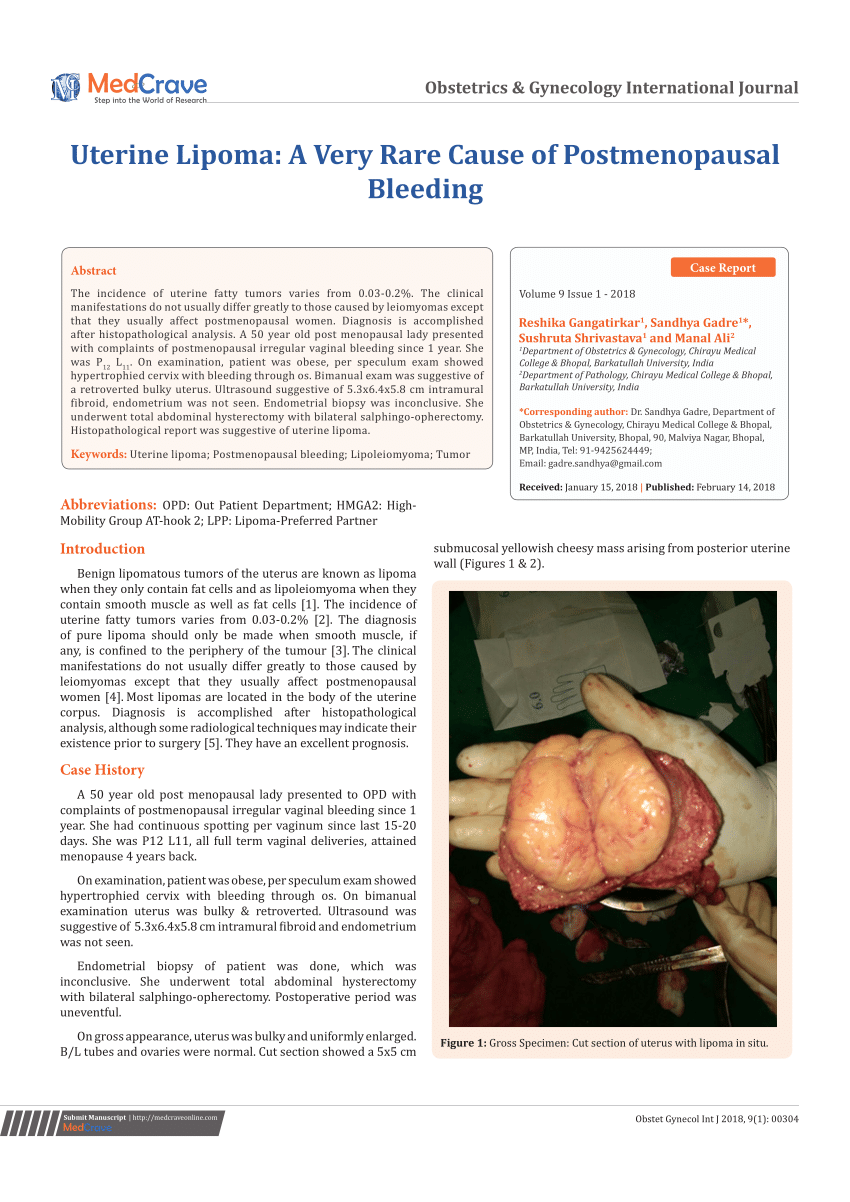 Pdf Uterine Lipoma A Very Rare Cause Of Postmenopausal Bleeding