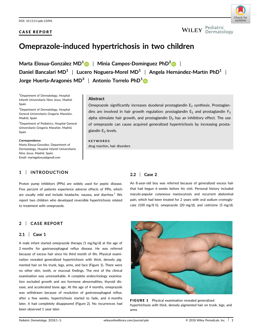 PDF) Omeprazole-induced hypertrichosis in two children