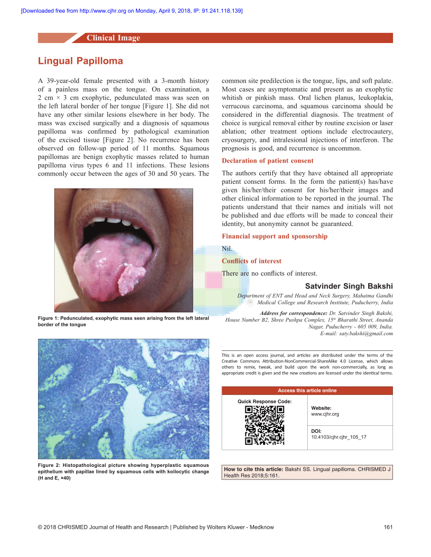 Papillomavirus lingual