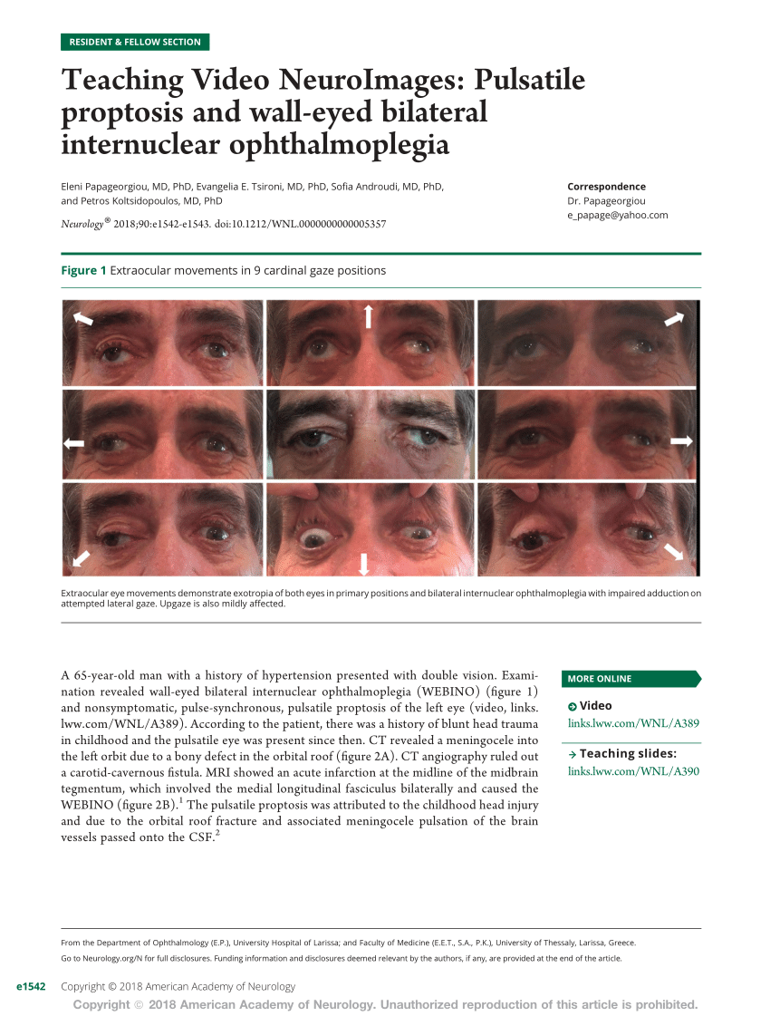 Cardinal positions of gaze - American Academy of Ophthalmology