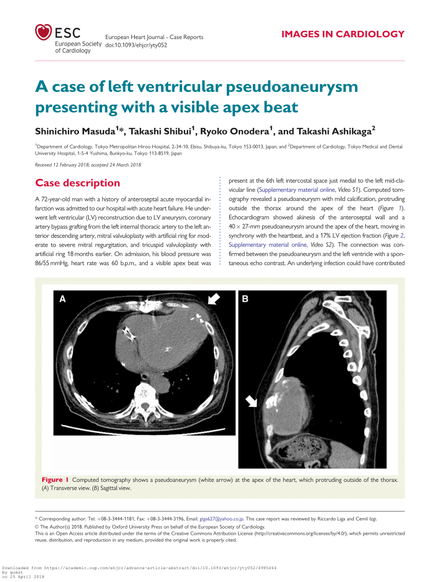 Pdf A Case Of Left Ventricular Pseudoaneurysm Presenting With A Visible Apex Beat
