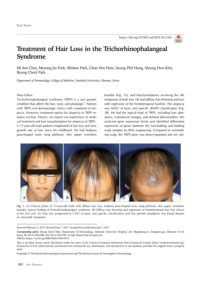 PDF) Treatment of Hair Loss in the Trichorhinophalangeal Syndrome
